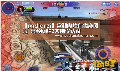 【pgdianzi】宫颈糜烂有癌变风险 宫颈糜烂2大错误认识(图4)