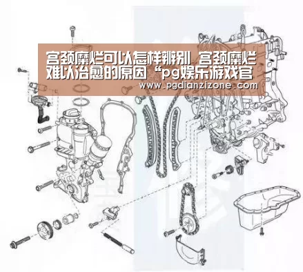 宫颈糜烂可以怎样辨别 宫颈糜烂难以治愈的原因“pg娱乐游戏官网”(图1) pg电子入口官网